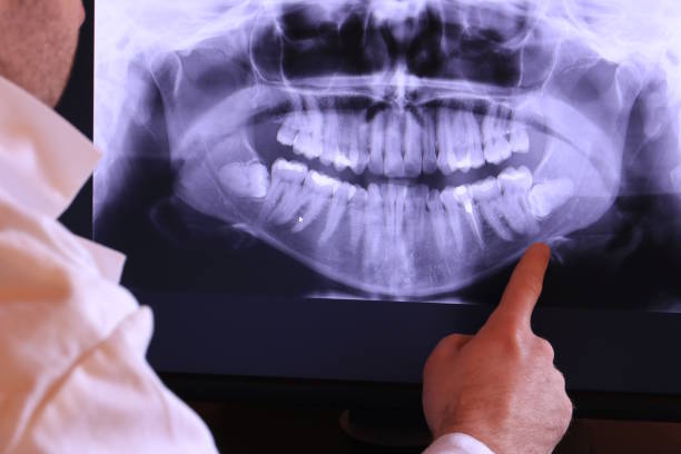 Best Walk-In Emergency Dental Services in Effort, PA