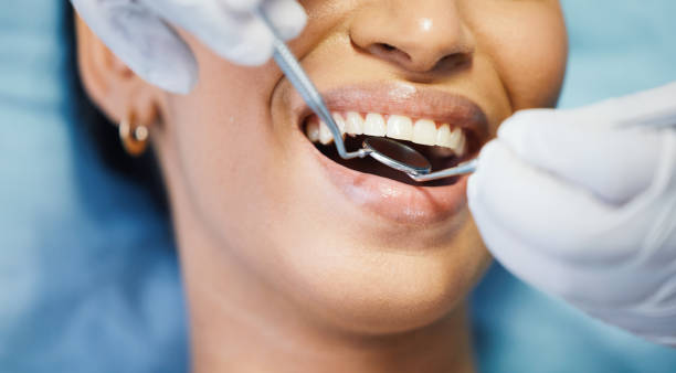 Best Broken or Chipped Tooth Repair in Effort, PA